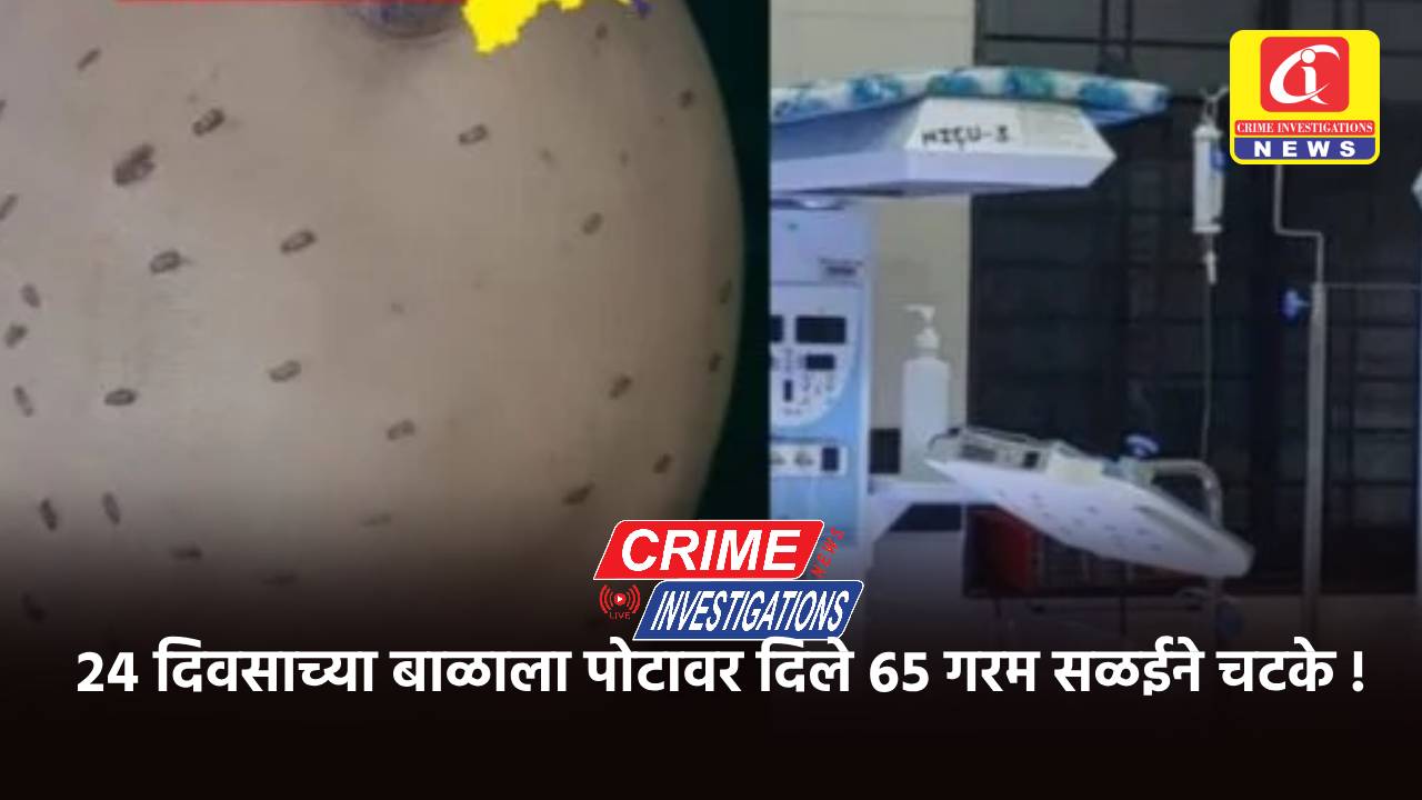 २४ दिवसाच्या बाळाला पोटावर दिले ६५ गरम सळईने चटके !