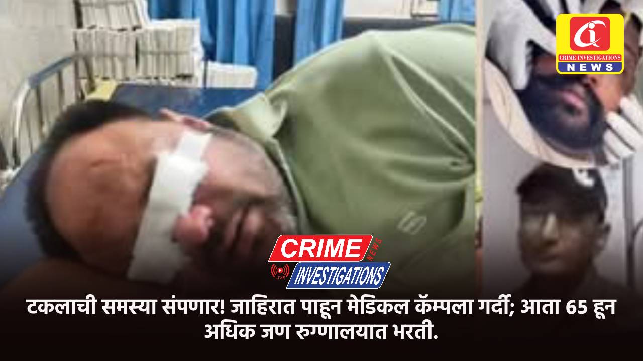 टकलाची समस्या संपणार! जाहिरात पाहून मेडिकल कॅम्पला गर्दी; आता ६५हून अधिक जण रुग्णालयात भरती.