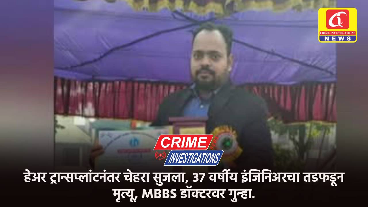 हेअर ट्रान्सप्लांटनंतर चेहरा सुजला, 37 वर्षीय इंजिनिअरचा तडफडून मृत्यू, MBBS डॉक्टरवर गुन्हा.